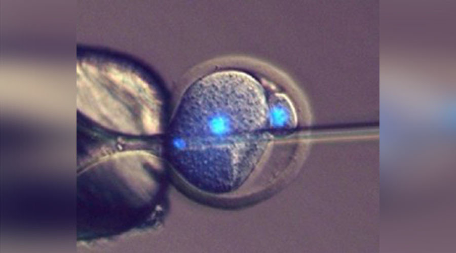 Mouse egg fertilization