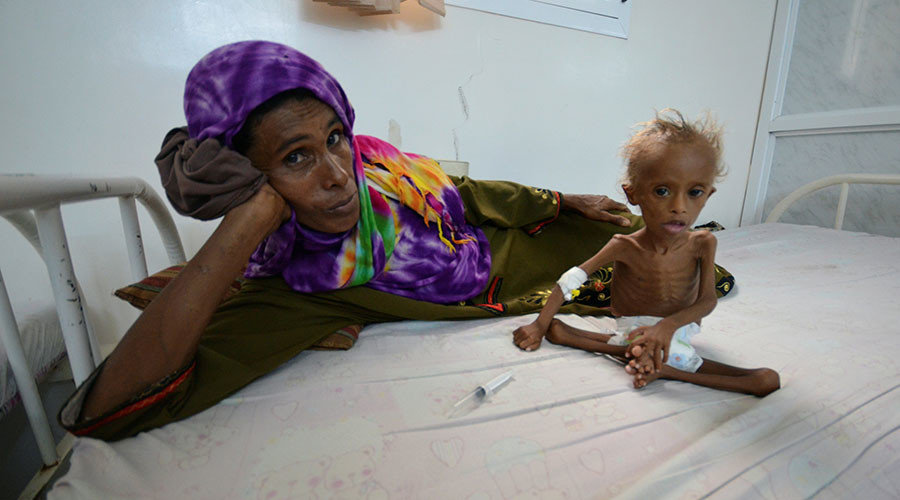 yemen starving children