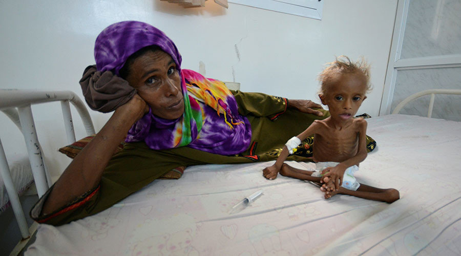Click to enlarge yemen starving children