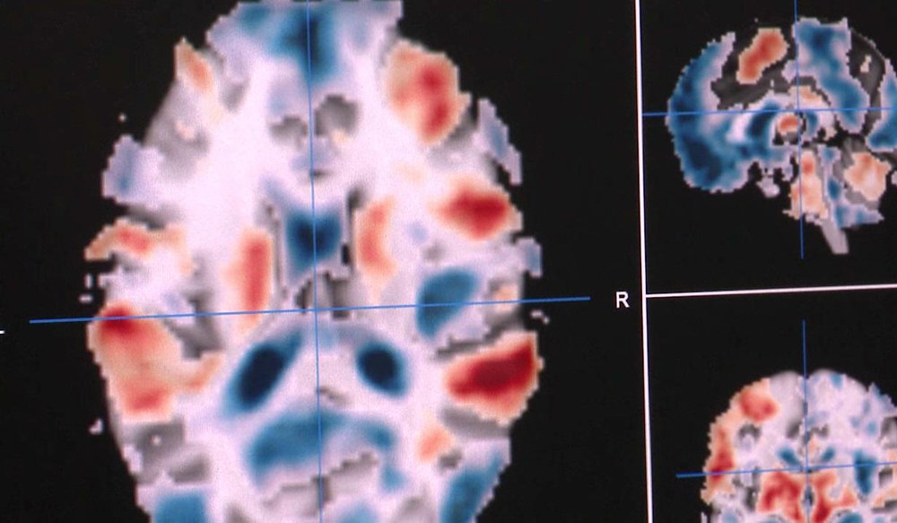 Click to enlarge Brain activation