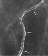 Click to enlarge breast artery