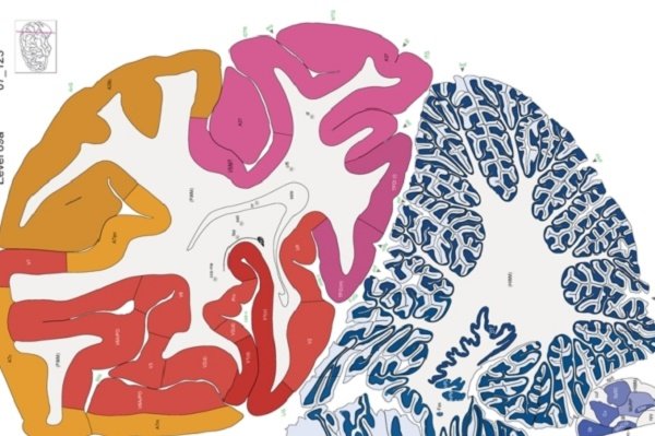 Click to enlarge Brain map