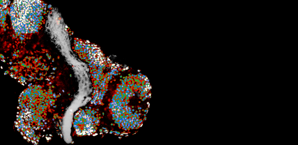 Click to enlarge neurons
