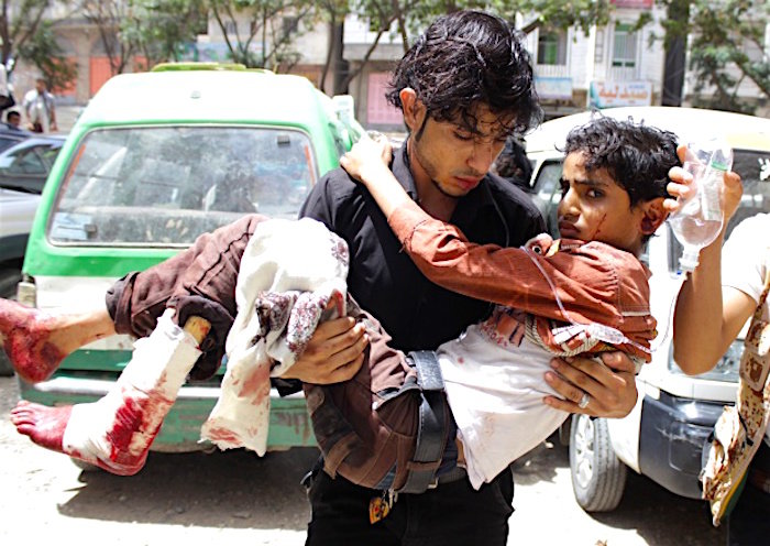 yemeni casualties