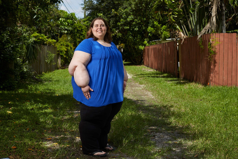Click to enlarge obesity,lack care obese