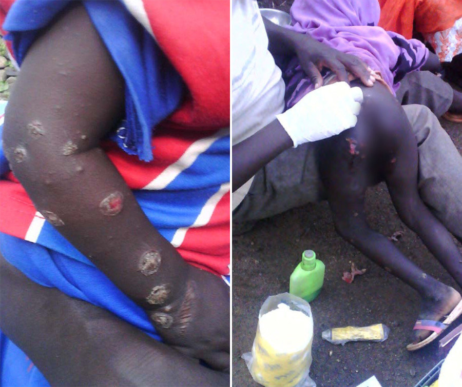Darfur chemical weapons attack