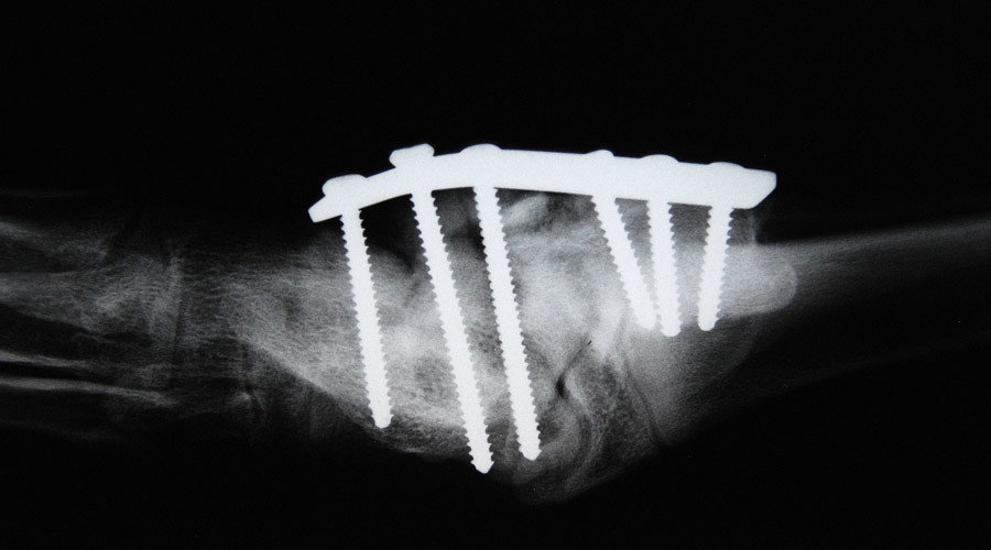 x ray