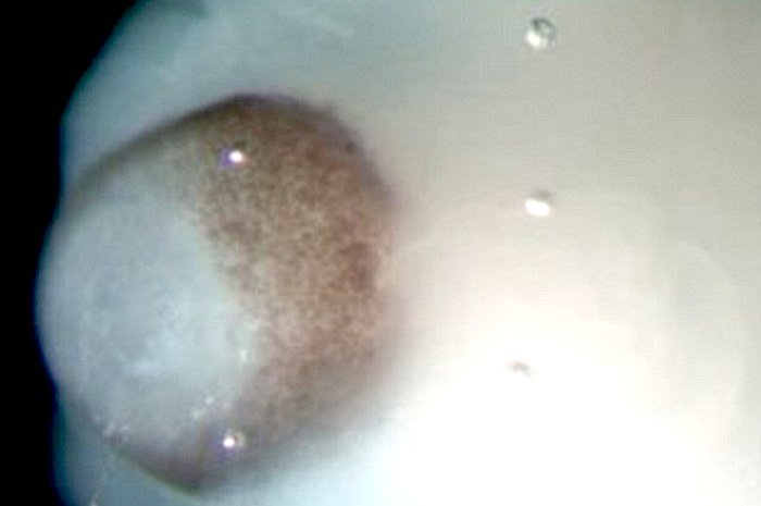 mini brain organoid