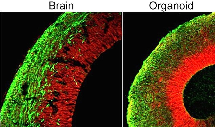 Brain/Organoid