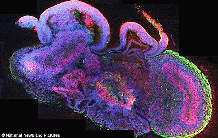 Click to enlarge cross section organoid