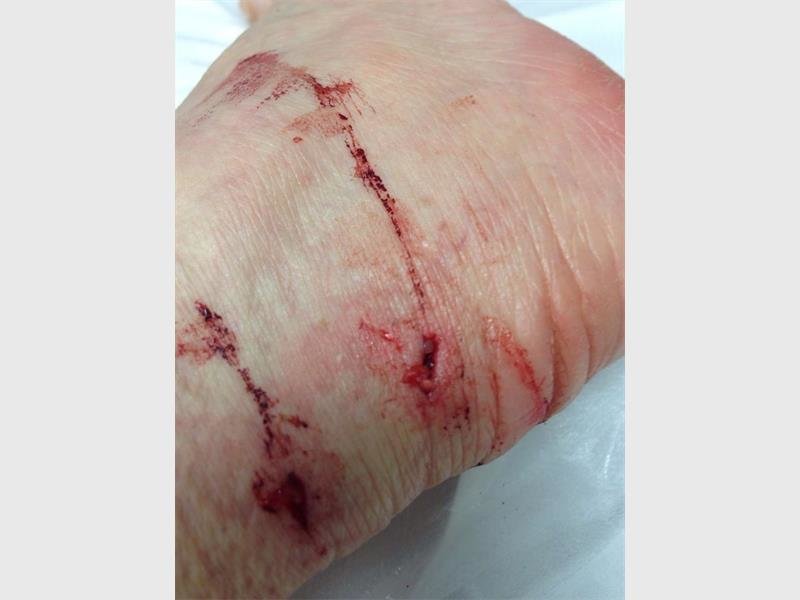 Click to enlarge The honey badger bit Gail on her ankle. She had to get five stitches.