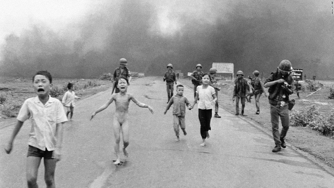 Vietnam napalm girl