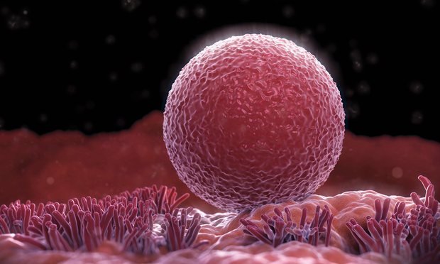Ovary