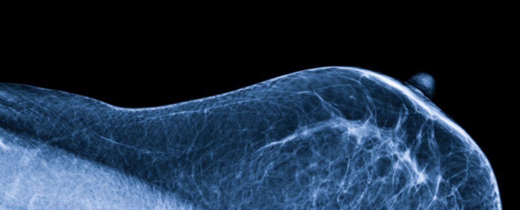 breast scan, breast microbiome