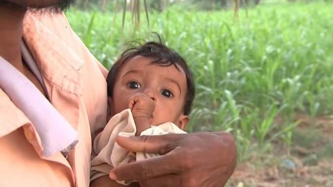 starving Yemen children