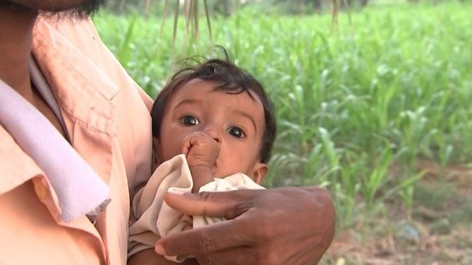 Click to enlarge starving Yemen children