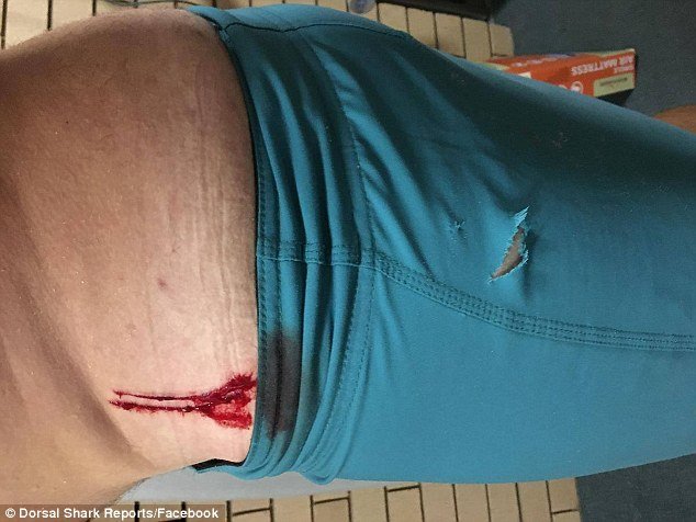 Click to enlarge Photographs of the man's wounds were uploaded to the Dorsal Shark Reports Facebook