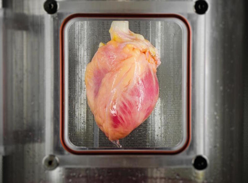 heart in a box