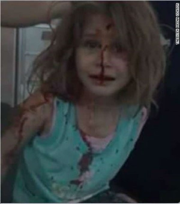 Click to enlarge injured girl