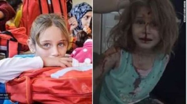 Click to enlarge injured girl contrast