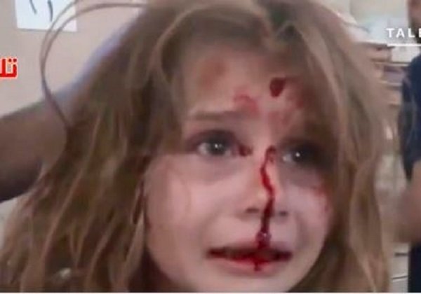 Click to enlarge injured girl 2