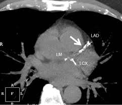 cat scan