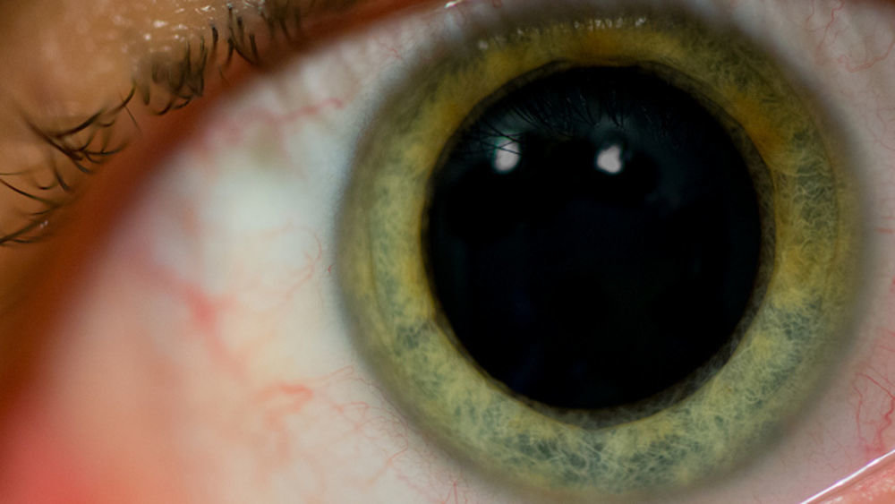 Eye pupil