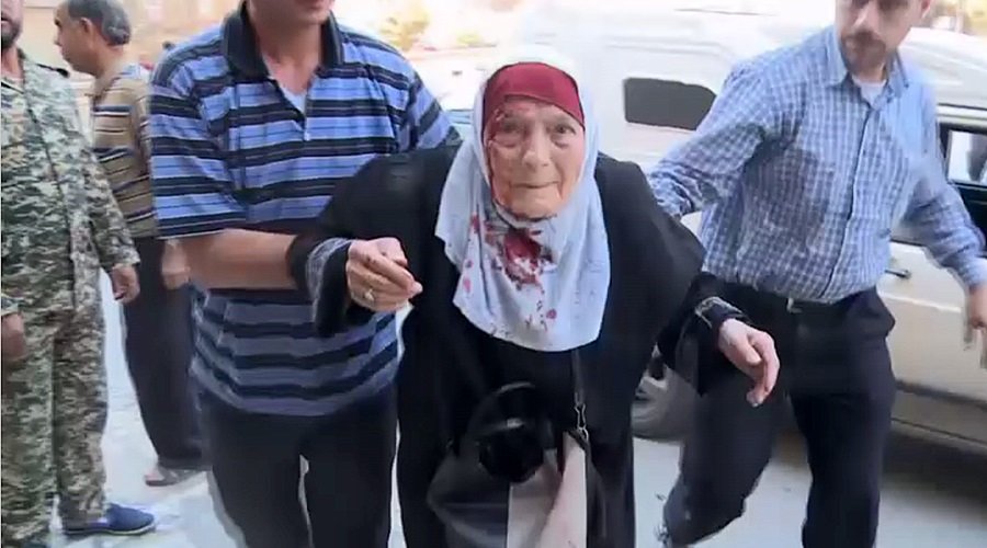 Click to enlarge Aleppo civilians injured in terror attack