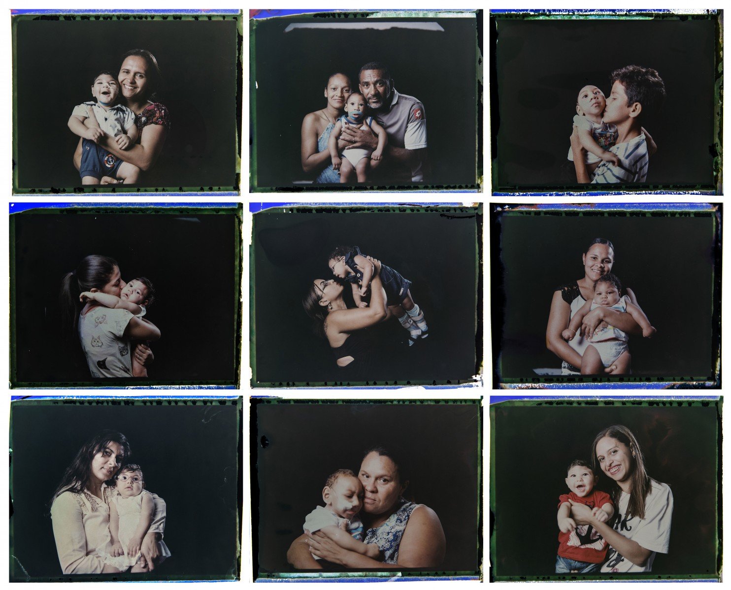Infants born with microcephaly and their family members