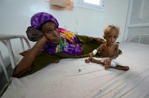 yemen war children