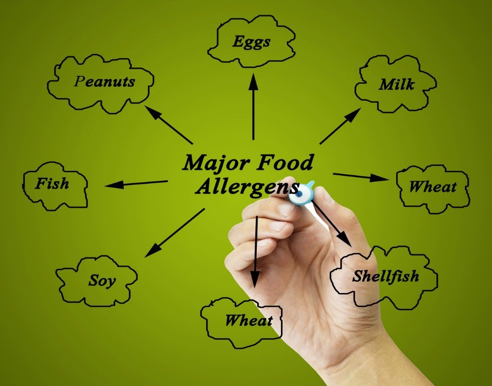 food allergies