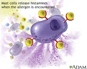 mast cells, histamine