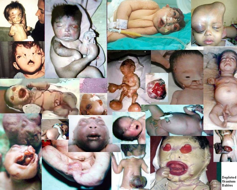 Image result for depleted uranium children