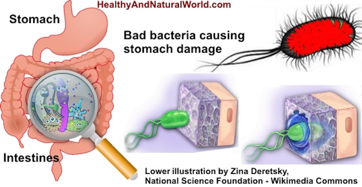 Helicobacter pylori sintomas diarrea