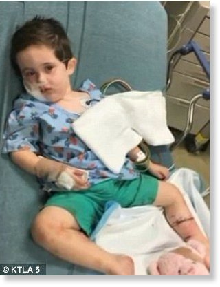 Click to enlarge Recovering: The little boy suffered extensive injuries and was taken to hospital. He had to undergo plastic surgery for a laceration to his face
