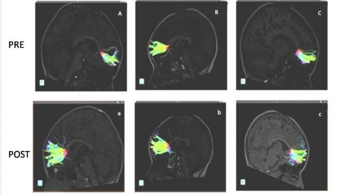Click to enlarge Music enhances brain connections