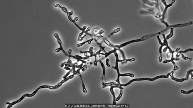 Ophidiomyces ophiodiicola 