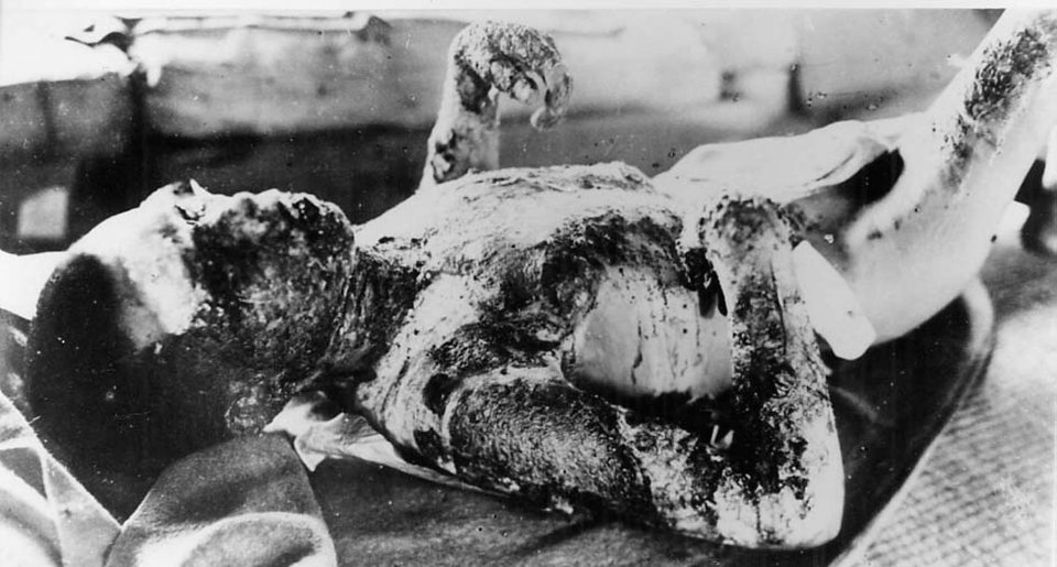 Click to enlarge Hiroshima victim