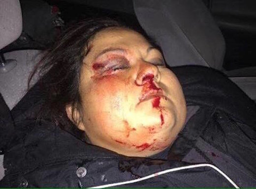 Vanessa Dundon Standing Rock protestor
