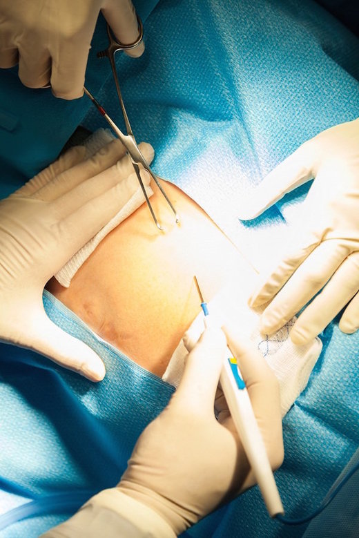 Click to enlarge c-section