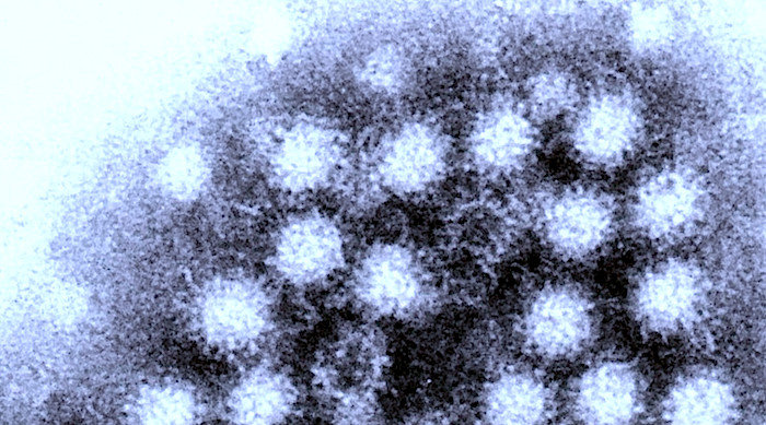 norovirus