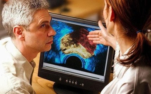 A man diagnosed with prostate cancer 