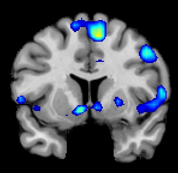 Click to enlarge Brain scan, religious experience