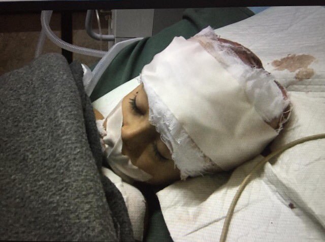 Click to enlarge five-year-old Syrian boy, named Dia died in Aleppo
