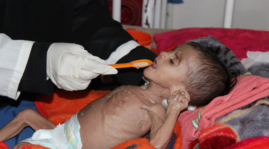 Click to enlarge yemen starving child