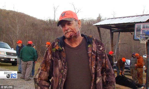 North Carolina hunter Mike Wilson came face to face with a 390lb bear and just narrowly survived the attack 
