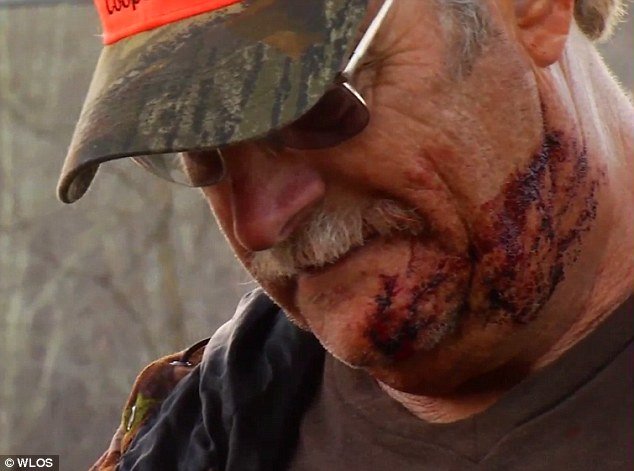 The bear scratched at Wilson's face and neck, only just barely missing his jugular vein