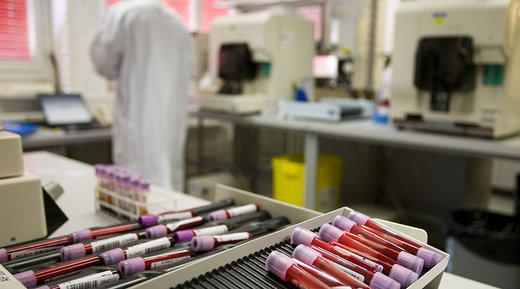 Doping testing blood samples