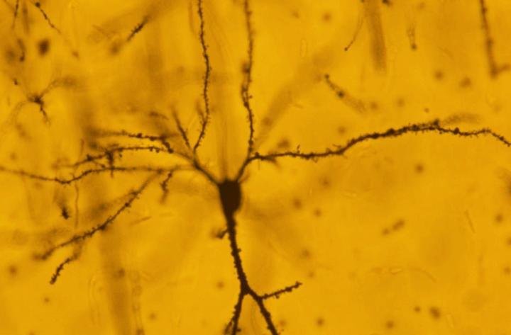 Pyramidal neuron