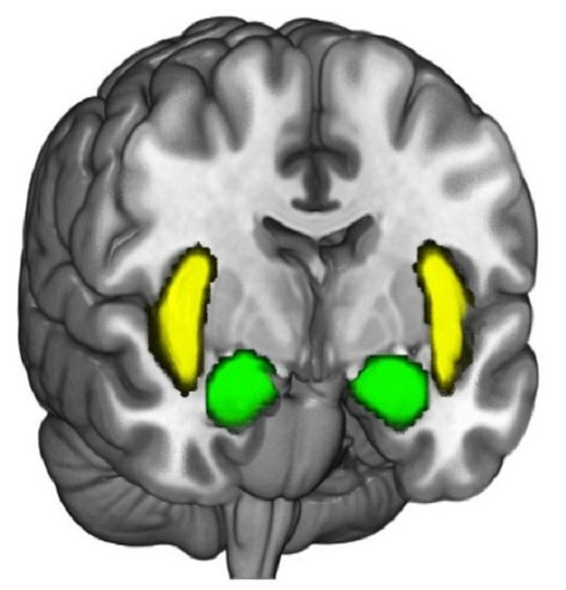 Click to enlarge Amygdala